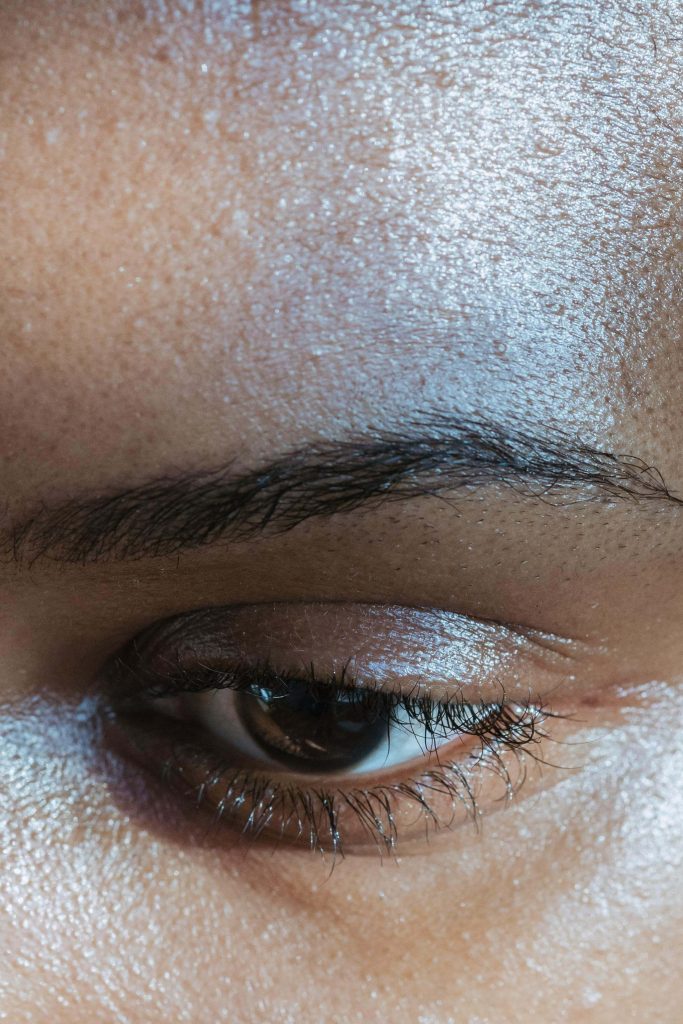Image illustrating Eyelid Surgery results in Miami, FL. (9) | Xiluet Plastic Surgery