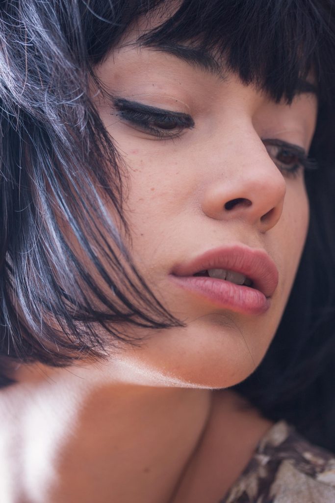 Image illustrating Eyelid Surgery results in Miami. (4) | Xiluet Plastic Surgery