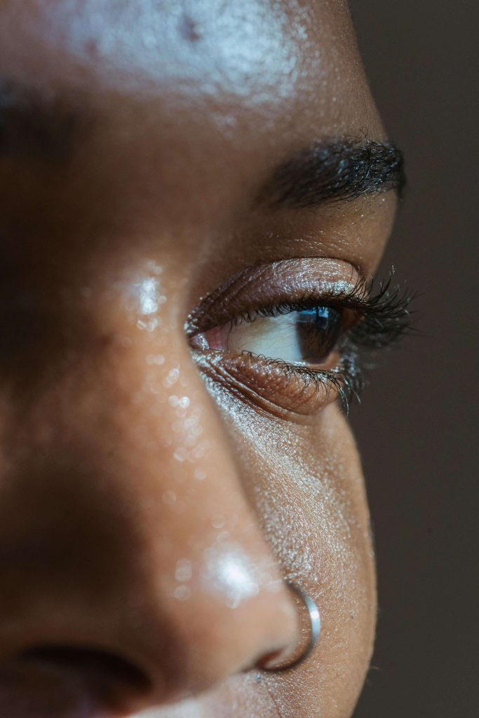 Image illustrating Eyelid Surgery results in Miami, FL. (7) | Xiluet Plastic Surgery