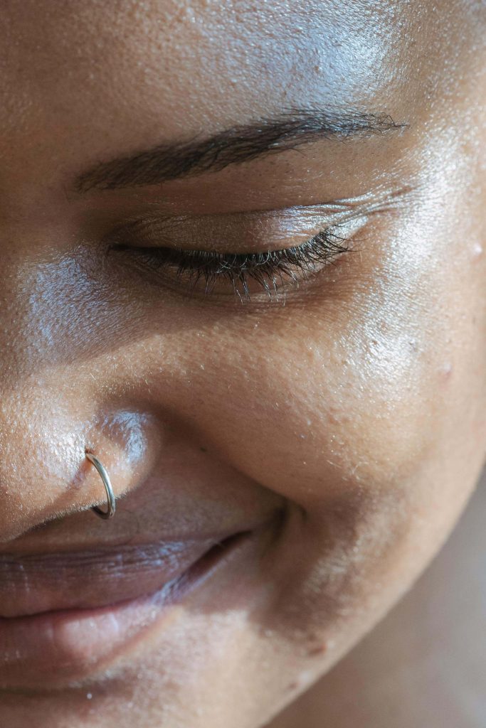Image illustrating Eyelid Surgery results in Miami, FL. (5) | Xiluet Plastic Surgery