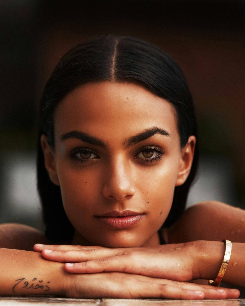 Imagen que ilustra los resultados del tratamiento cosmético de equilibrio facial en Miami, FL. (3) | Cirugía Plástica Xiluet