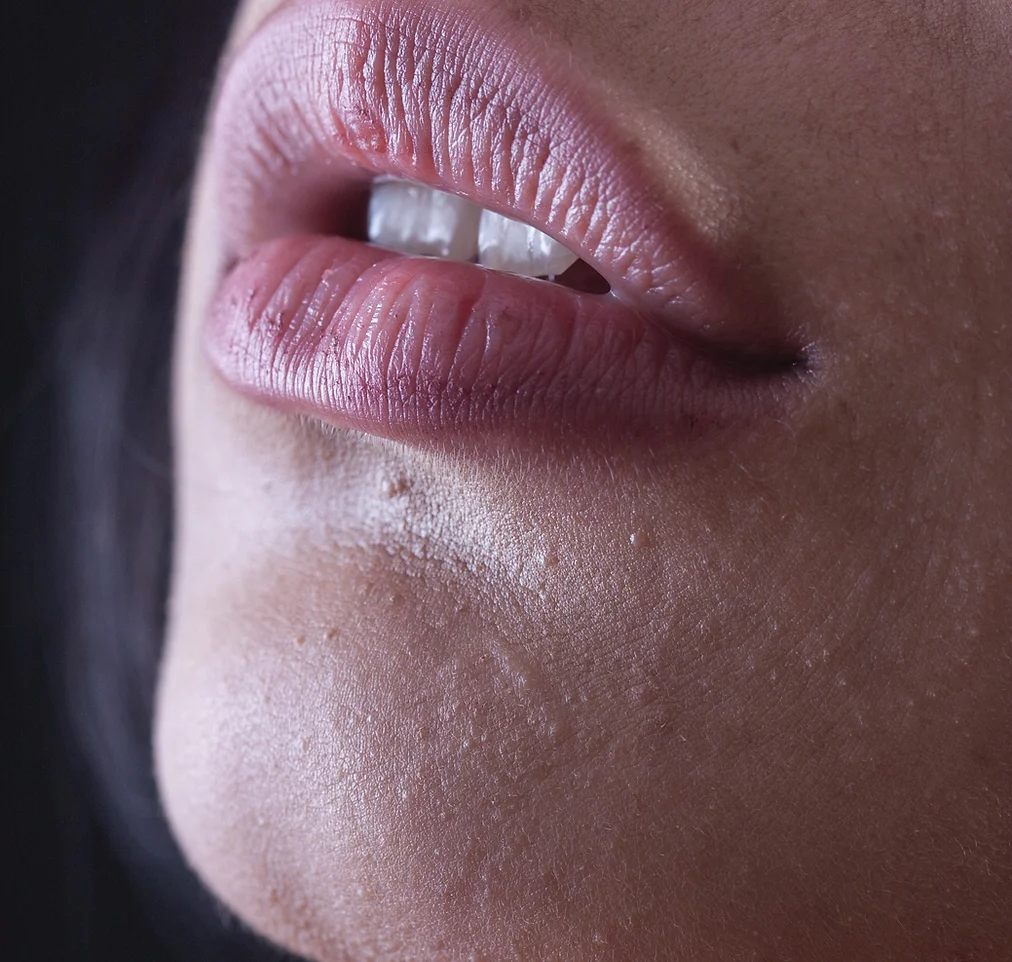 Lip Fillers Cosmetic Procedure