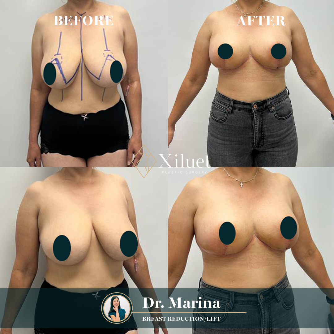 B&A_MAR2